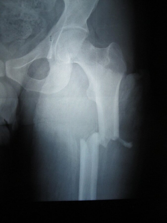 1-kÃƒÂƒÃ‚Â„ÃƒÂ‚Ã‚Â±rÃƒÂƒÃ‚Â„ÃƒÂ‚Ã‚Â±k hali.JPG